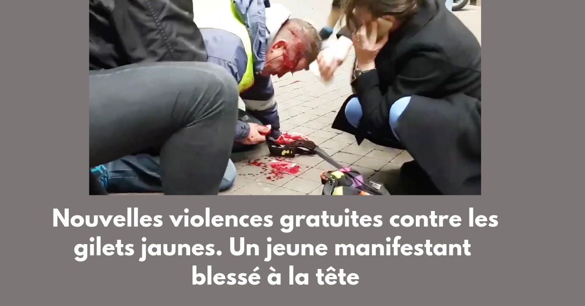 Read more about the article Nouvelles violences policières contre les gilets jaunes. D’insupportables images en provenance de Bordeaux prouvent un acharnement du pouvoir contre les citoyens.